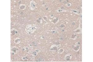 IHC-P analysis of Human Brain Tissue, with DAB staining. (ENO2/NSE antibody  (AA 2-285))