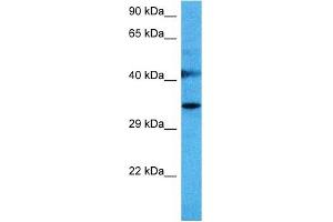 Host:  Mouse  Target Name:  SPRY1  Sample Tissue:  Mouse Liver  Antibody Dilution:  1ug/ml (SPRY1 antibody  (N-Term))