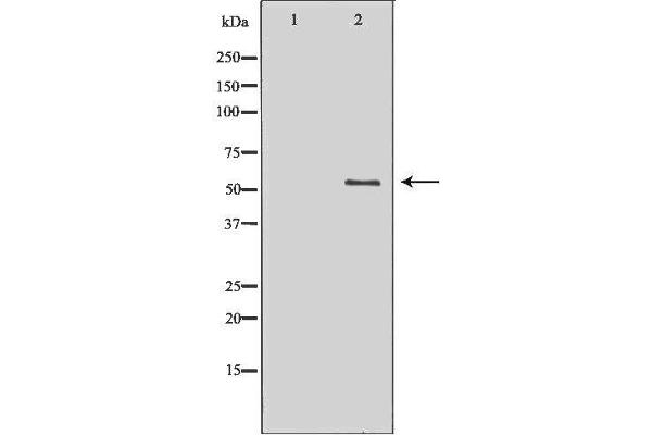PDZK1 Antikörper  (C-Term)