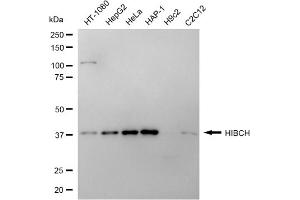 Western blotting analysis using HIBCH antibody (ABIN7797420).