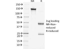 SDS-PAGE Analysis of Purified Beta-Catenin Mouse Monoclonal Antibody (15B8). (CTNNB1 antibody)