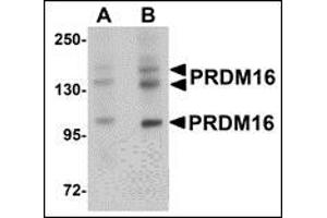 Western blot analysis of PRDM16 in rat brain tissue lysate with AP30689PU-N PRDM16 antibody at (A) 1 and (B) 2 μg/ml. (PRDM16 antibody  (C-Term))