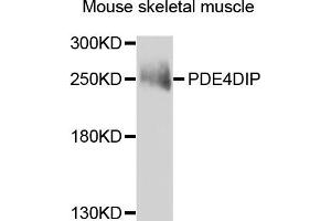 Western blot analysis of extracts of mouse skeletal muscle, using PDE4DIP antibody. (PDE4DIP antibody)