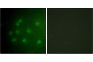 Immunofluorescence analysis of COS7 cells, using Retinoblastoma (Phospho-Thr826) Antibody. (Retinoblastoma Protein (Rb) antibody  (pThr826))