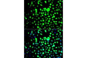 Immunofluorescence analysis of A549 cell using ZBTB25 antibody. (ZBTB25 antibody)