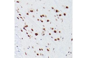 Immunohistochemistry of paraffin-embedded Mouse spinal cord using NSUN5 antibody ( ABIN7268955) at dilution of 1:100 (40x lens).