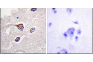 Immunohistochemistry analysis of paraffin-embedded human brain, using GRK1 (Phospho-Ser21) Antibody. (GRK1 antibody  (pSer21))