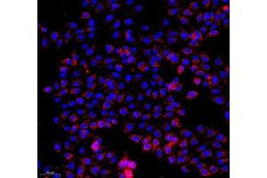 Immunocytochemistry analysis of 4 % paraformaldehyde-fixed HepG2 cells using COX5B (ABIN7073665) at dilution of 1: 1000 (200x lens) (COX5B antibody)