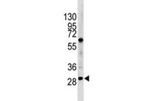 Western blot analysis of LIN28B antibody and HL-60 lysate (LIN28B antibody  (AA 1-30))