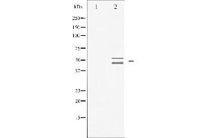 Western blot analysis of VASP expression in NIH-3T3 whole cell lysates,The lane on the left is treated with the antigen-specific peptide. (VASP antibody  (Internal Region))
