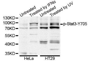 Western blot analysis of extracts of HT-29 cell line, using Phospho-Stat3-Y705 antibody.