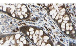 ABIN6272628 at 1/100 staining Rat colon tissue by IHC-P. (ADAM8 antibody  (Internal Region))