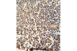 Immunohistochemistry (IHC) image for anti-DNA Segment, MCA1, Multiple CA Repeat 1 (MCA1) antibody (ABIN3002773) (MCA1 antibody)