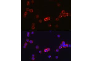 Immunofluorescence analysis of TF-1 cells using J Rabbit pAb (ABIN6134375, ABIN6142642, ABIN6142643 and ABIN6213974) at dilution of 1:50 (40x lens). (JAK3 antibody  (AA 750-850))