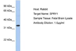 WB Suggested Anti-SPRY1 Antibody Titration:  0. (SPRY1 antibody  (N-Term))