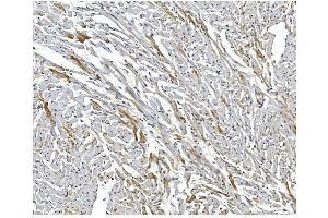 IHC analysis of ARF6 using anti-ARF6 antibody (ABIN4886473). (ARF6 antibody  (AA 2-175))