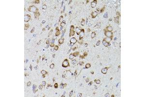 Immunohistochemistry (IHC) image for anti-Prolyl 4-Hydroxylase, beta Polypeptide (P4HB) antibody (ABIN6134876)