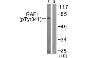 Western blot analysis of extracts from Jurkat cells treated with Paclitaxel using Raf1 (Phospho-Tyr341) Antibody. (RAF1 antibody  (pTyr341))