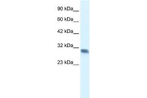 WB Suggested Anti-FHL2 Antibody Titration:  0.