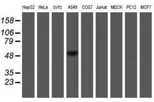 Image no. 10 for anti-NADH Dehydrogenase (Ubiquinone) Complex I, Assembly Factor 7 (NDUFAF7) antibody (ABIN1499667) (NDUFAF7 antibody)