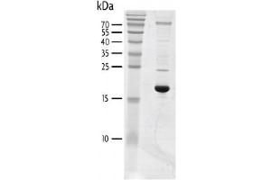 Recombinant BRD3 (24-144) protein gel.