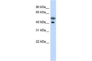 Tropomodulin 2 antibody used at 1 ug/ml to detect target protein.