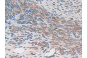 Detection of GSN in Mouse Uterus Tissue using Polyclonal Antibody to Gelsolin (GSN) (Gelsolin antibody  (AA 432-625))