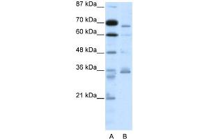 WB Suggested Anti-PCSK6 Antibody Titration:  2. (PCSK6 antibody  (N-Term))