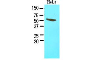 Western Blotting (WB) image for anti-FK506 Binding Protein 4, 59kDa (FKBP4) (AA 1-459), (N-Term) antibody (ABIN371865) (FKBP4 antibody  (N-Term))