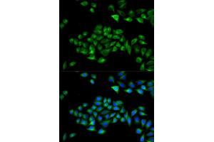 Immunofluorescence analysis of U2OS cells using PCM1 Rabbit pAb (ABIN7269217) at dilution of 1:50,1:100,1:200 (40x lens). (PCM1 antibody  (AA 1-260))