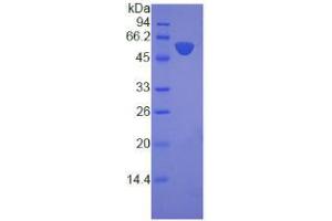 SDS-PAGE analysis of Human Laminin beta 3 Protein.