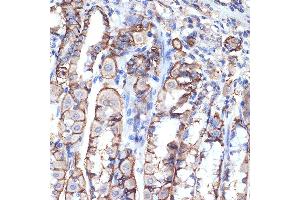 Immunohistochemistry (IHC) image for anti-Vacuolar Protein Sorting 11 Homolog (VPS11) antibody (ABIN7271272)