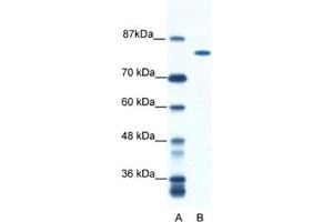 Western Blotting (WB) image for anti-DEAH (Asp-Glu-Ala-His) Box Polypeptide 16 (DHX16) antibody (ABIN2461579) (DHX16 antibody)