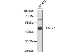Western blot analysis of extracts of BT-474 cells, using CD177 antibody (ABIN6131282, ABIN6138125, ABIN6138127 and ABIN6222217) at 1:1000 dilution. (CD177 antibody  (AA 35-285))