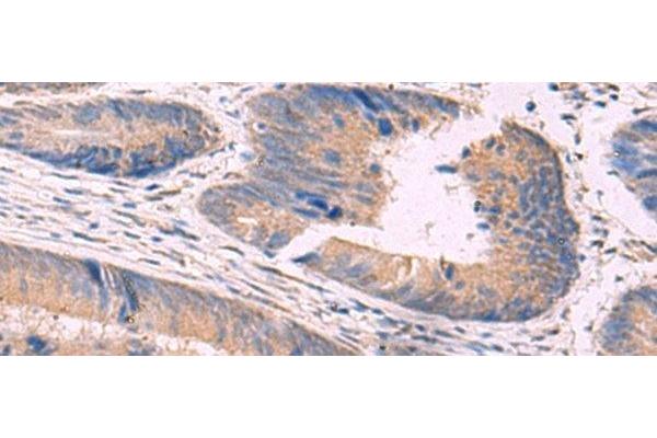 NIPSNAP1 antibody