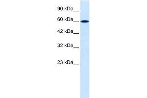 WB Suggested Anti-DACH2 Antibody Titration:  0. (DACH2 antibody  (C-Term))