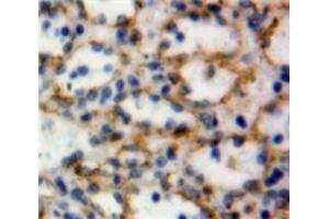 Used in DAB staining on fromalin fixed paraffin-embedded Spleen tissue (CD39 antibody  (AA 98-352))
