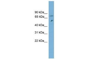 DYNC1I2 antibody used at 1 ug/ml to detect target protein. (DYNC1I2 antibody  (N-Term))