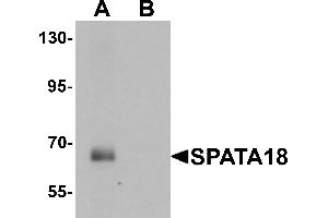 Western blot analysis of SPATA18 in rat lung tissue lysate with SPATA18 antibody at 1 µg/mL in (A) the absence and (B) the presence of blocking peptide