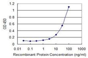 Detection limit for recombinant GST tagged USP6 is 1 ng/ml as a capture antibody. (USP6 antibody  (AA 2-89))