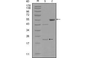 Western blot analysis using EPHA5 mouse mAb against truncated EPHA5-His recombinant protein (1) and truncated EPHA5(aa620-774)-hIgGFc transfected CHO-K1 cell lysate(2). (EPH Receptor A5 antibody)