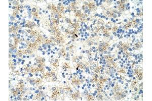 EXOSC6 antibody was used for immunohistochemistry at a concentration of 4-8 ug/ml to stain Hepatocytes (arrows) in Human Liver.