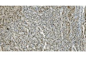 IHC analysis of Transketolase/TKT using anti-Transketolase/TKT antibody (ABIN7598958). (TKT antibody  (AA 1-116))