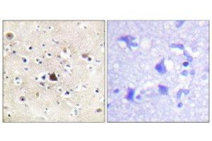 Immunohistochemistry (IHC) image for anti-GR (Internal Region), (pSer234), (Ser226), (Ser246) antibody (ABIN1847938) (GR (Internal Region), (pSer234), (Ser226), (Ser246) antibody)