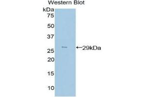 Western Blotting (WB) image for anti-Proto-Oncogene Pim-2 (Serine Threonine Kinase) (PIM2) (AA 98-319) antibody (ABIN1860222) (PIM2 antibody  (AA 98-319))