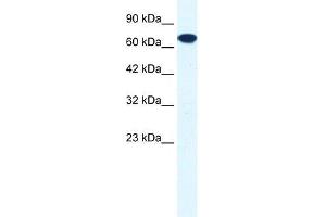 Human HepG2; WB Suggested Anti-ZNF179 Antibody Titration: 0.