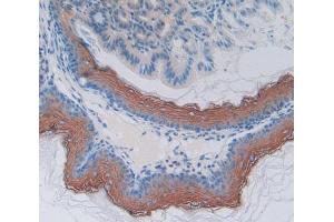 Used in DAB staining on fromalin fixed paraffin- embedded esophagus tissue