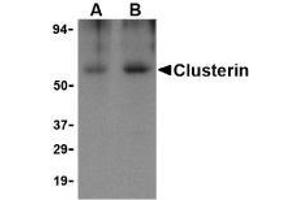 Western blot analysis of Clusterin in human brain tissue lysate with AP30239PU-N Clusterin body at (A) 0.