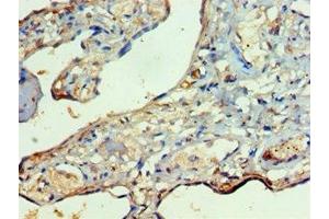 Immunohistochemistry of paraffin-embedded human placenta tissue using ABIN7167479 at dilution of 1:100 (RIPK3 antibody  (AA 1-120))