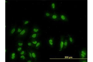 Immunofluorescence of monoclonal antibody to GATA2 on HeLa cell. (GATA2 antibody  (AA 1-102))